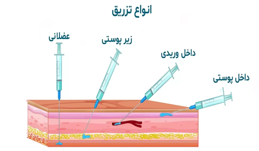 انواع تزریق سوماتروپین در بدنسازی