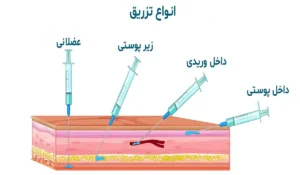  سنتروناکس - خرید سنتروناکس
